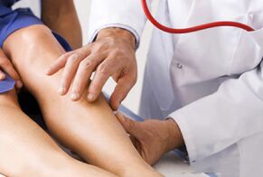 Varicose veins in the legs