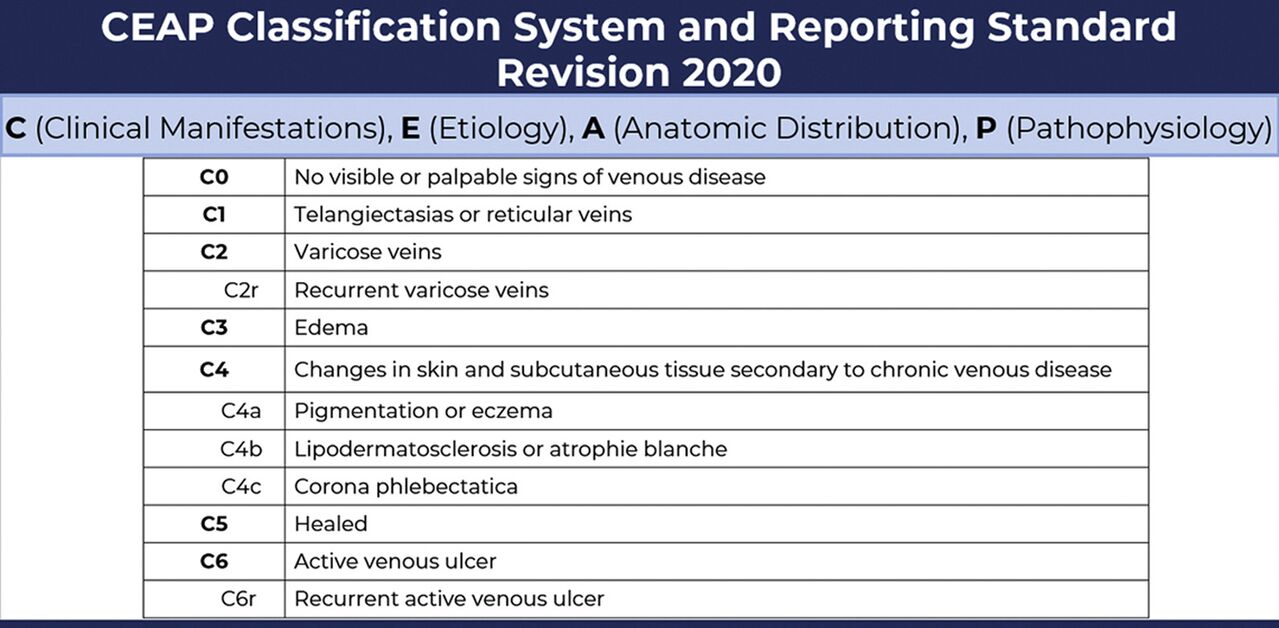 Stages of varicose veins according to the CEAP classification amended in 2020